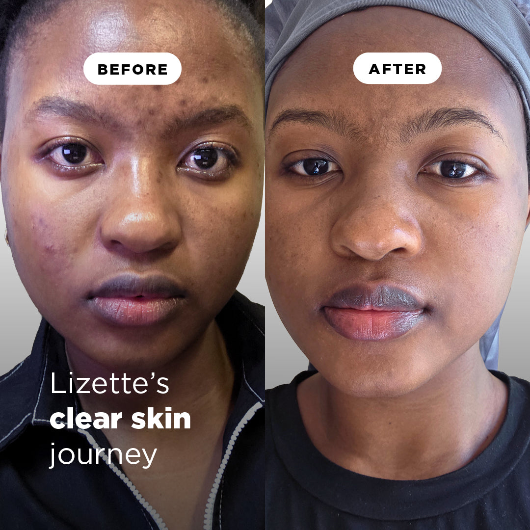 4 Step Routine For Brighter Skin