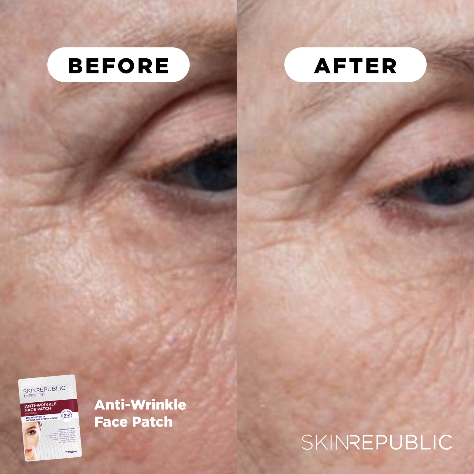 Anti-Wrinkle Face Patch + Peptides (12 Patches)