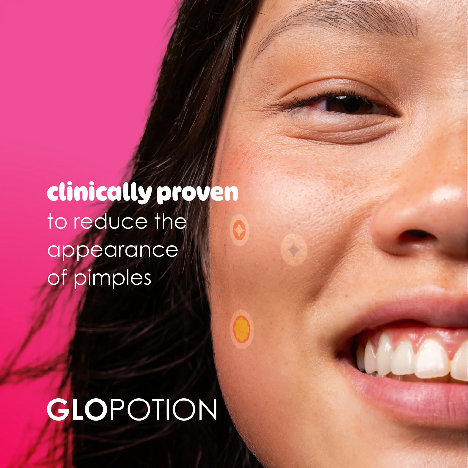GloPotion salicylic acid pimple patches (36 patches)