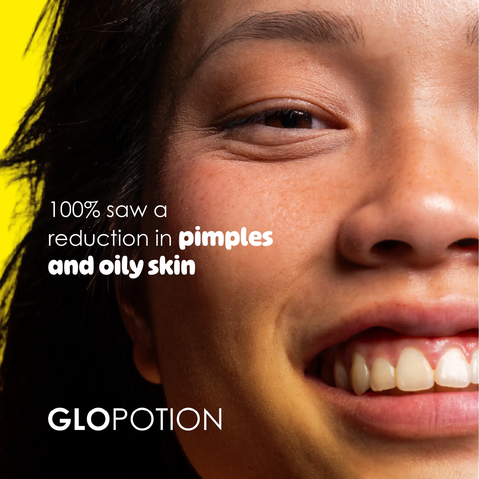 GloPotion niacinamide 10% + rice water serum