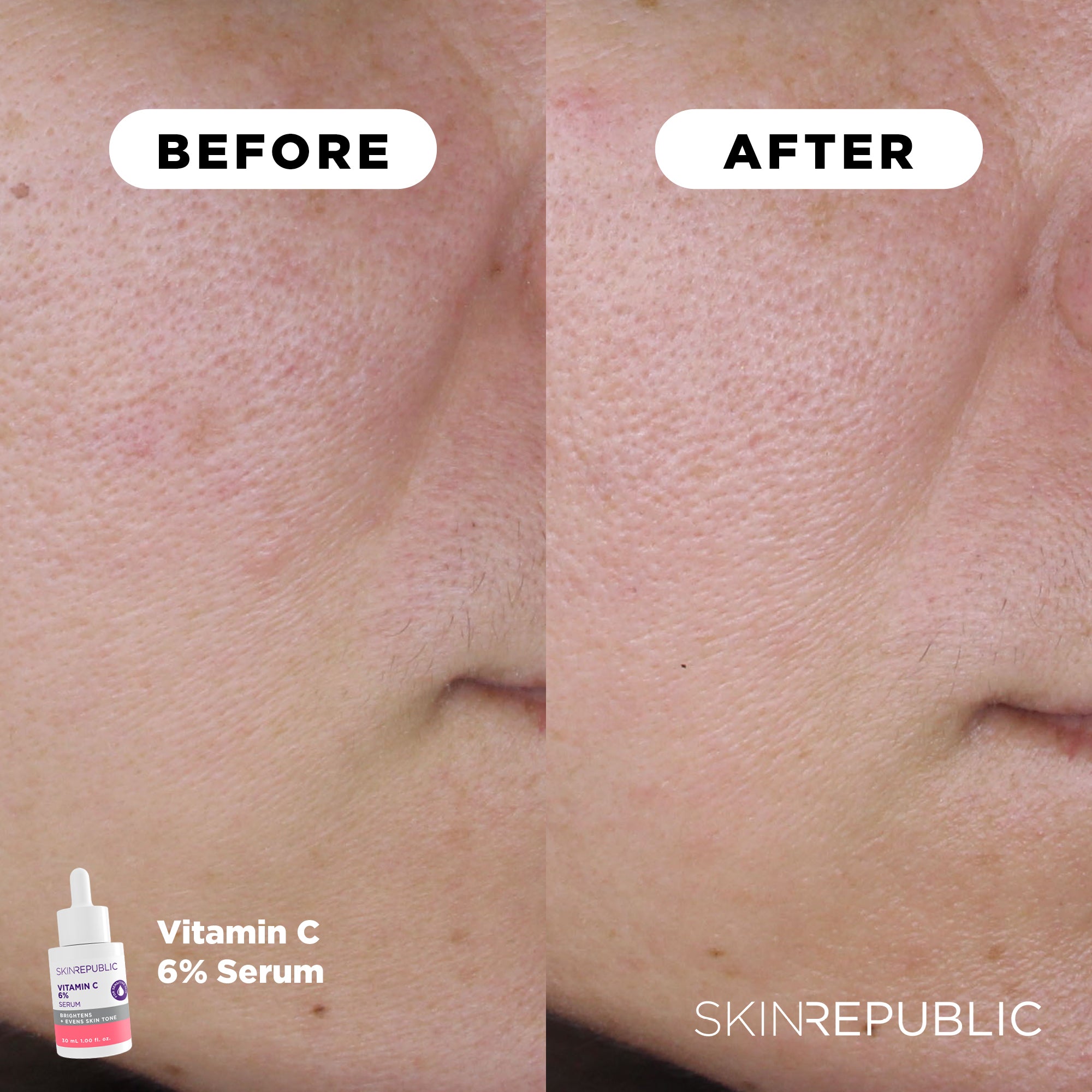 Vitamin C 6% Brightening Serum | Skin Republic SA - Skin Republic