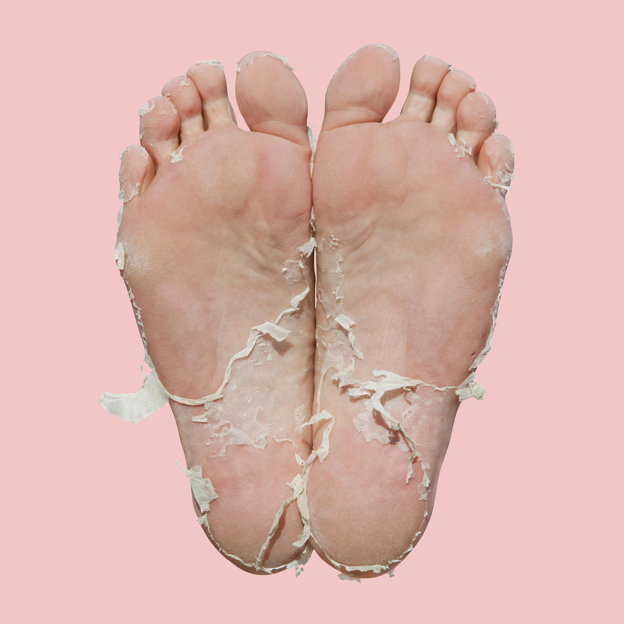 This foot peel mask provides soft, smooth results that fans love