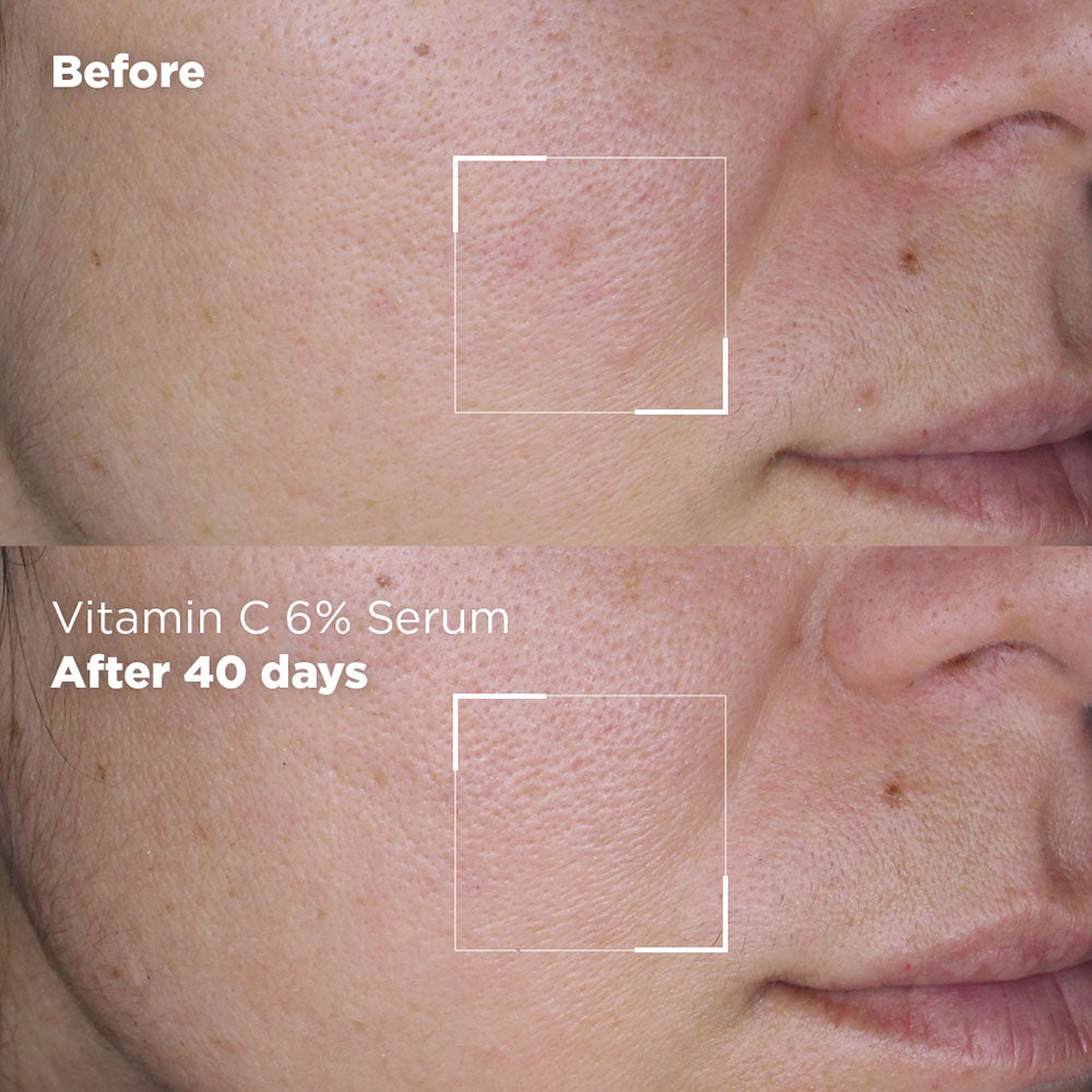 Vitamin C 6% Serum - Skin Republic - South Africa - Skin Republic South ...