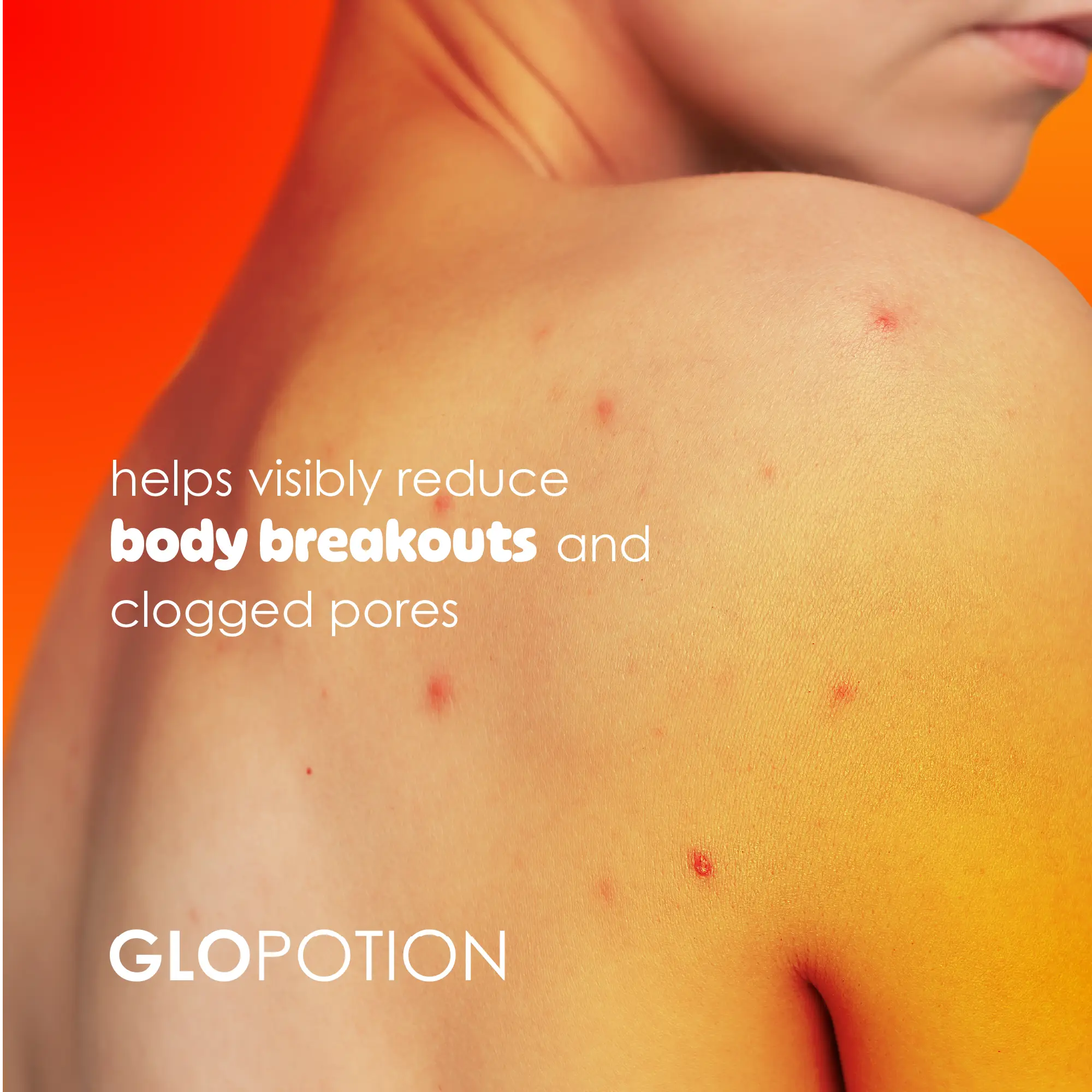 Glycolic Acid 5% + Niacinamide 5% + Zinc Body Spray | GloPotion SA
