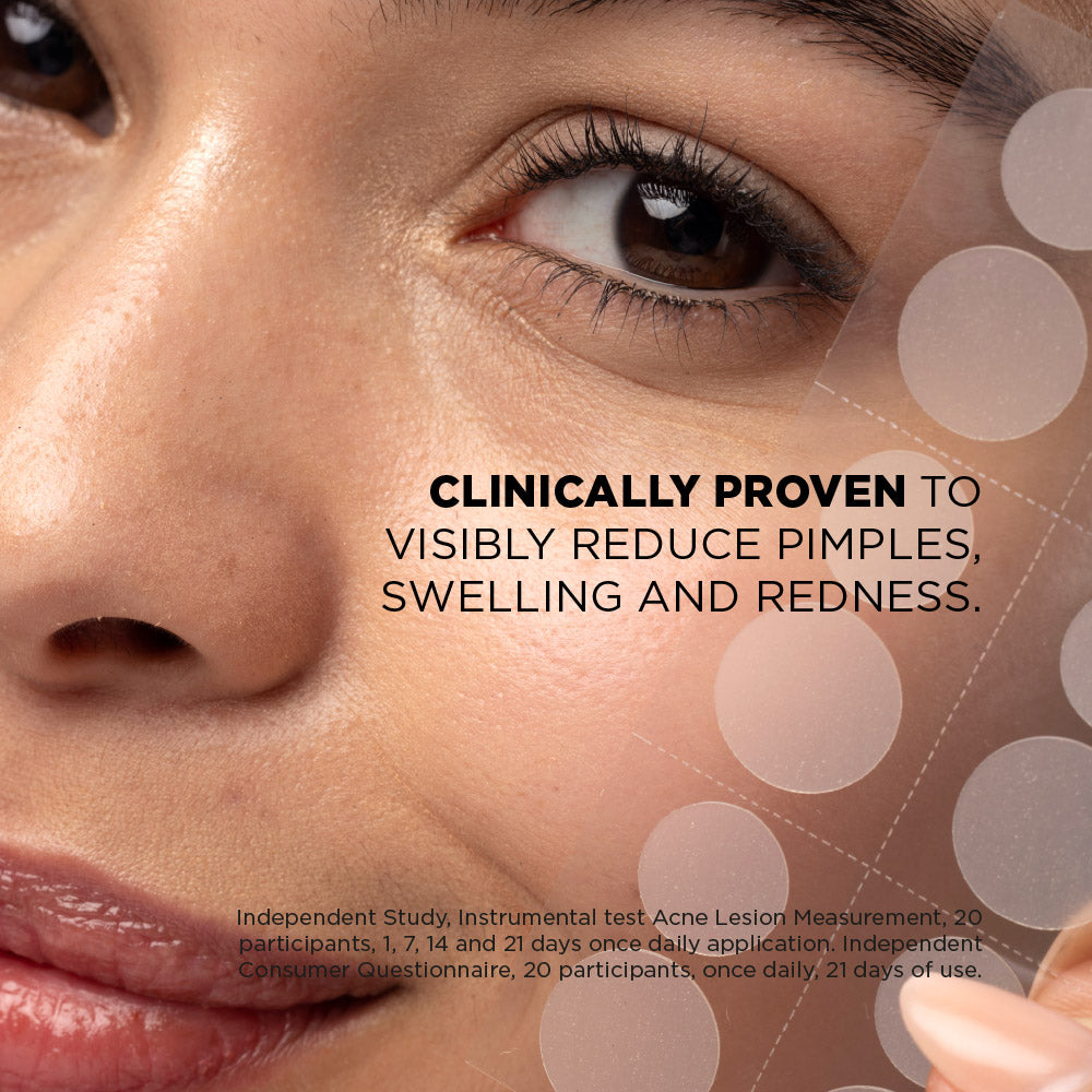 Spot Clear Salicylic Acid Patch (48 Patches)